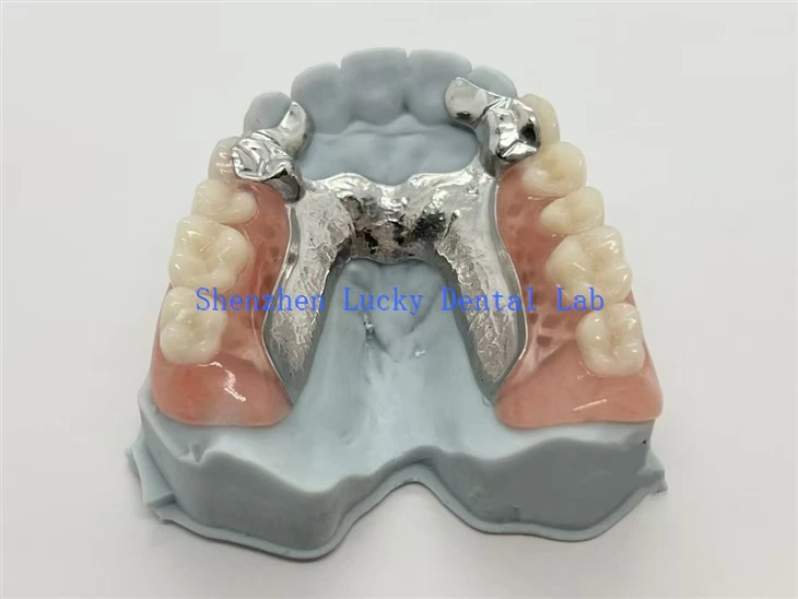 Cíor fiacla Páirteach Miotail Le Tacaíocht Fiacail Alloy